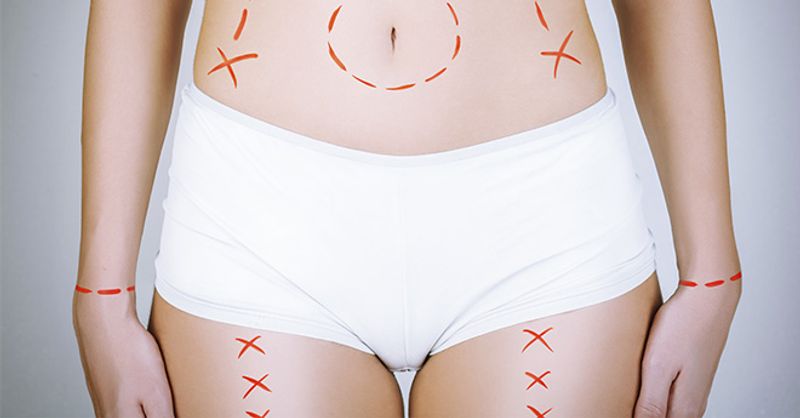 Blog Post Main Image