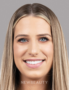 Dr. Nathan Hoffman - Smile Makeover - After