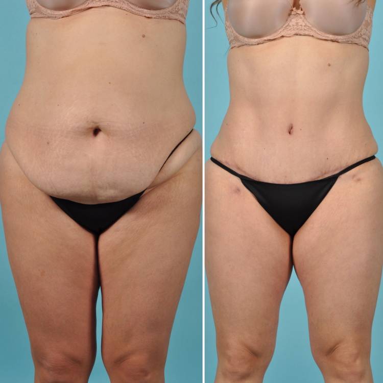 Grand Rapids, MI plastic surgeon David Alfonso, MD
