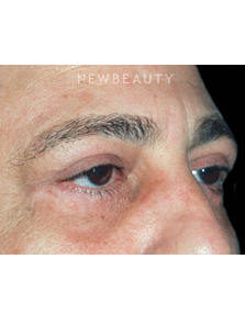 Dr. Roman Rayham - A Bright New Look - After