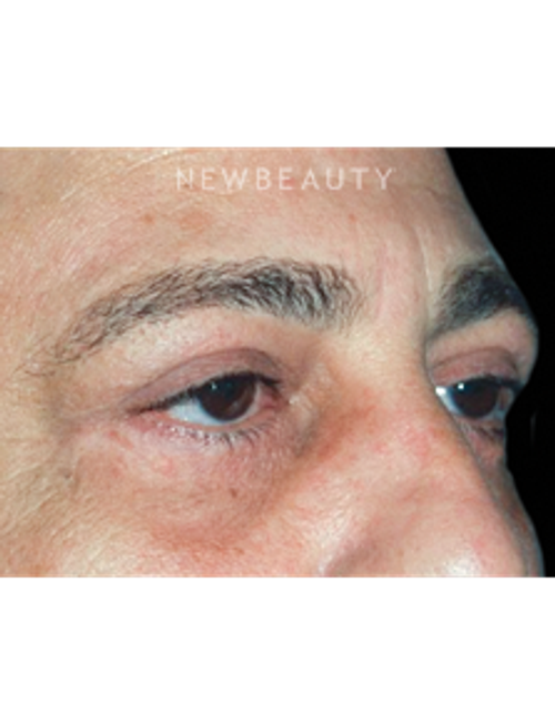 Dr. Roman Rayham - A Bright New Look - After