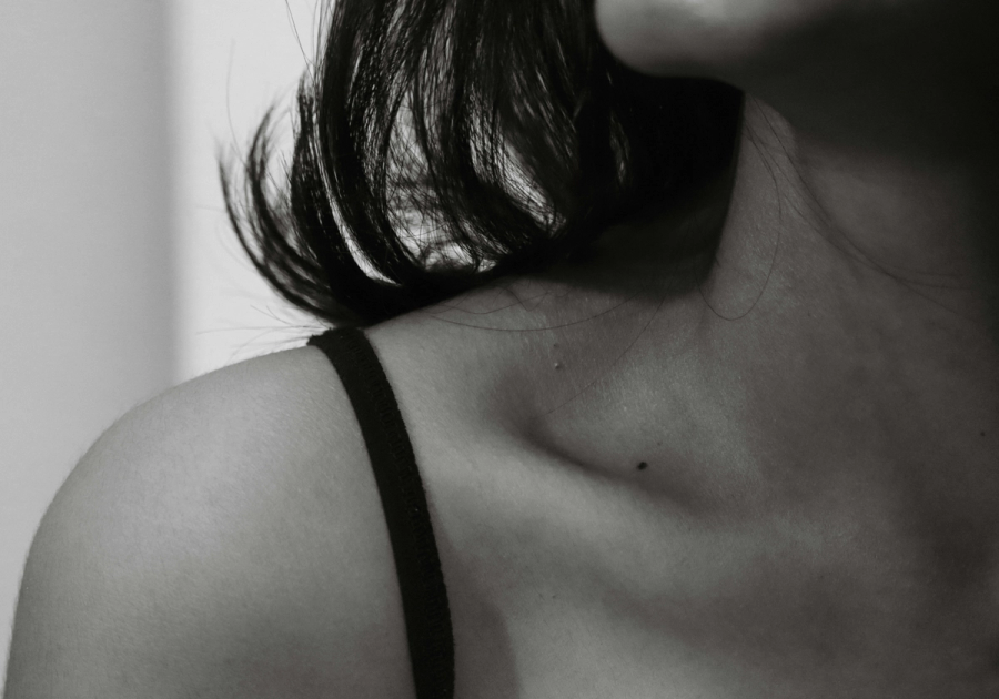 Which Hidradenitis Suppurativa Biologic Holds Up Best?