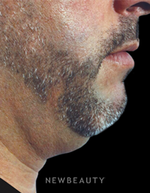 Dr. Marina Peredo - Improved Profile - Before