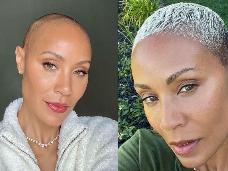 Jada Pinkett Smith’s Alopecia Journey: The Star Shares an Update