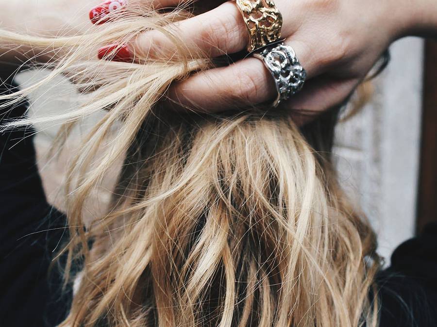 hairloss