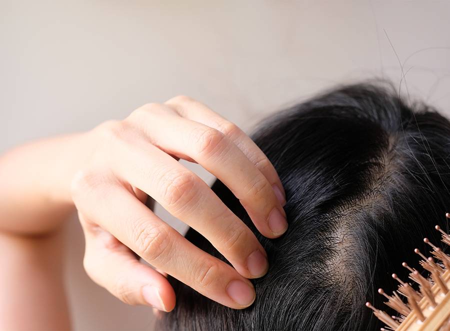 skin cancer dandruff