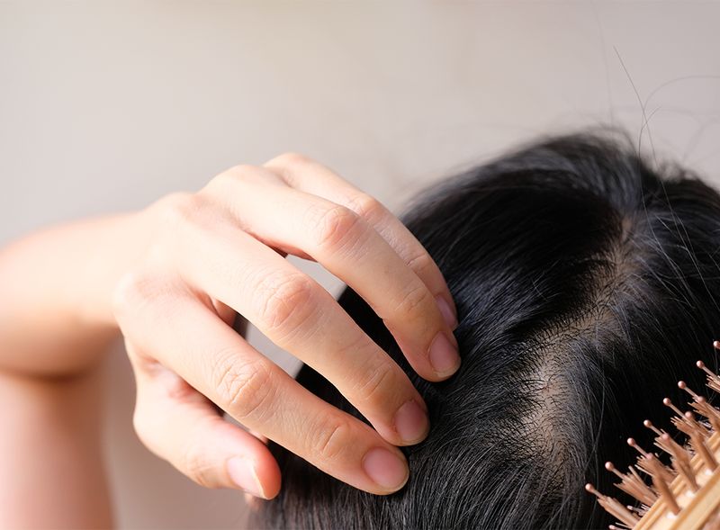 skin cancer dandruff