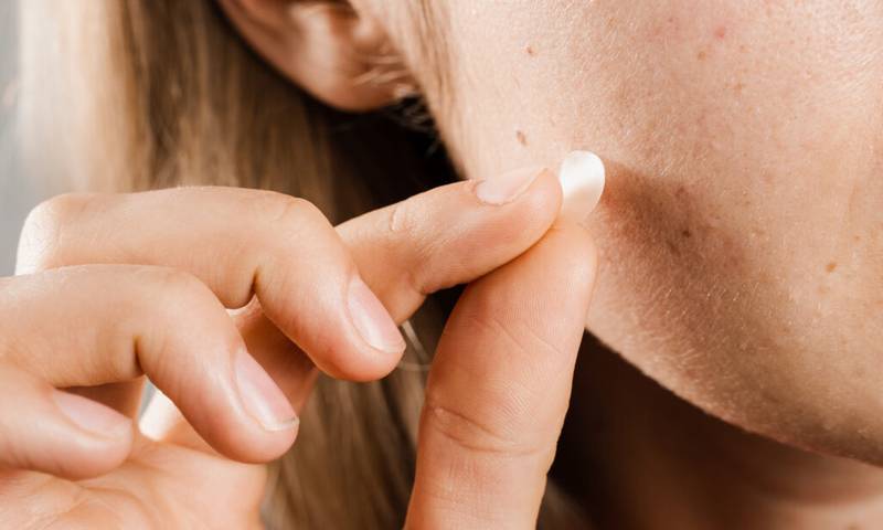 pimple patch acne