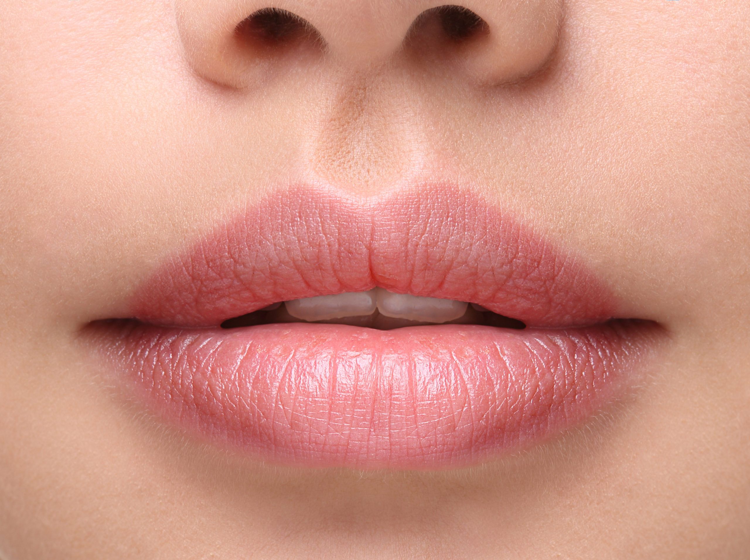 Juvederm Lips