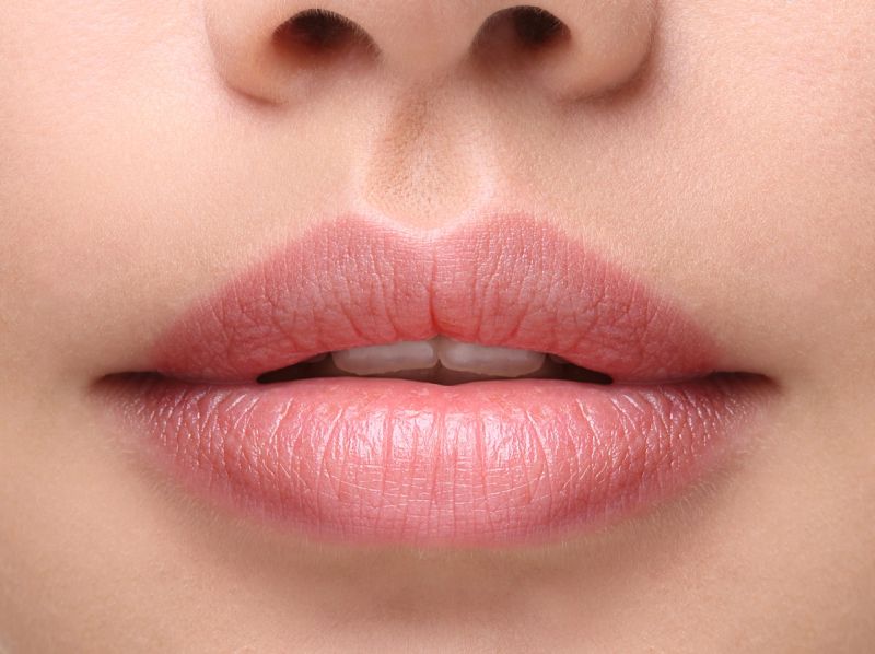 Juvederm Lips