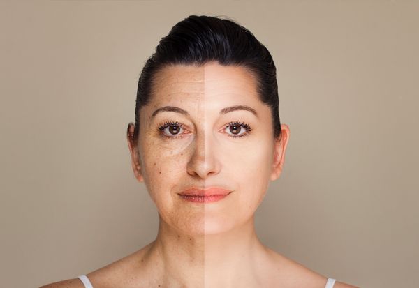 The Truth Behind Faked Before and After Plastic Surgery Images