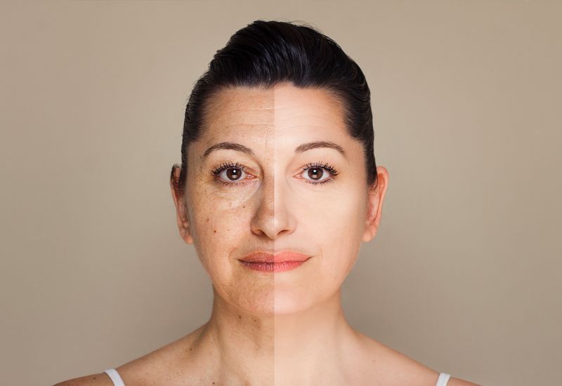 The Truth Behind Faked Before and After Plastic Surgery Images