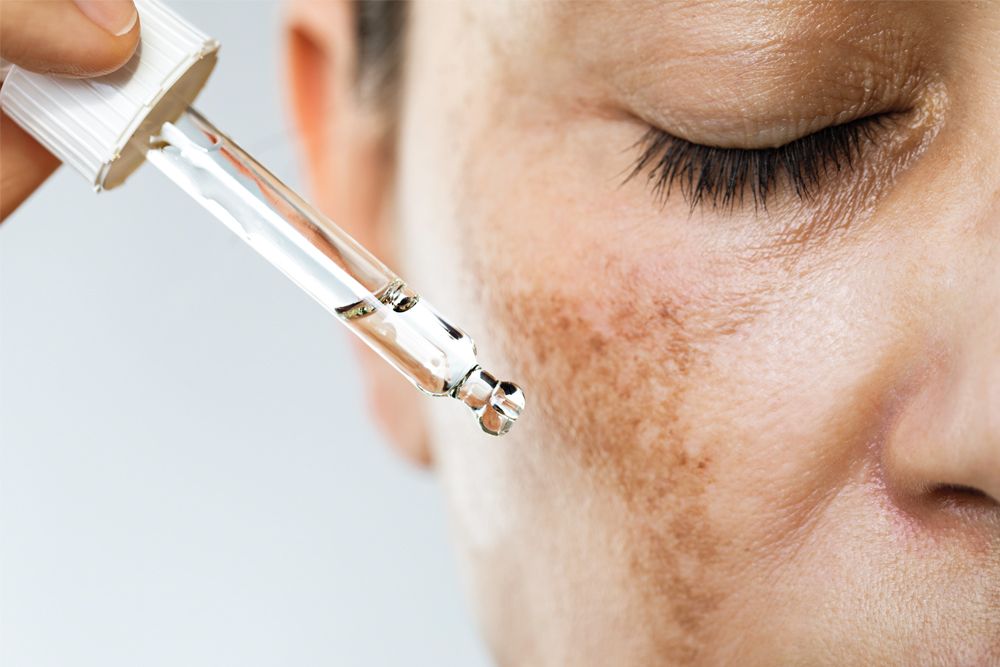 woman applying serum to dark spots on cheek