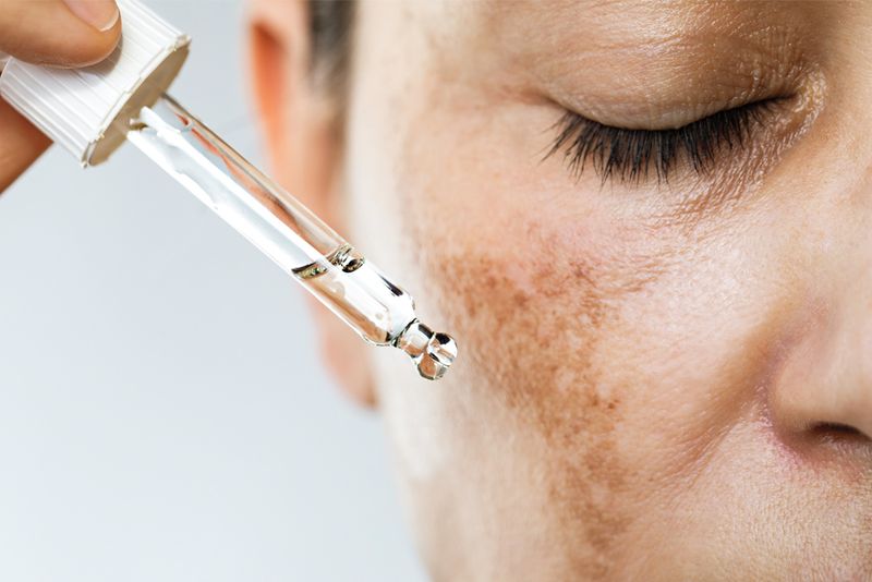 woman applying serum to dark spots on cheek