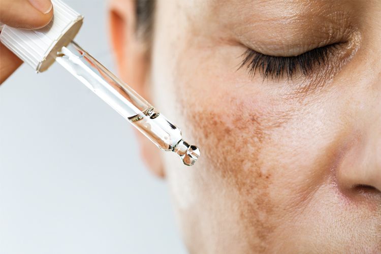 woman applying serum to dark spots on cheek