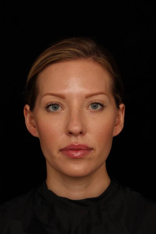 Dr. Jennifer M. Segal - Brighter Appearance - After