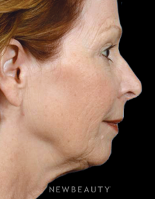 Dr. Bryan W. Gawley - Refreshed and Rejuvenated - Before