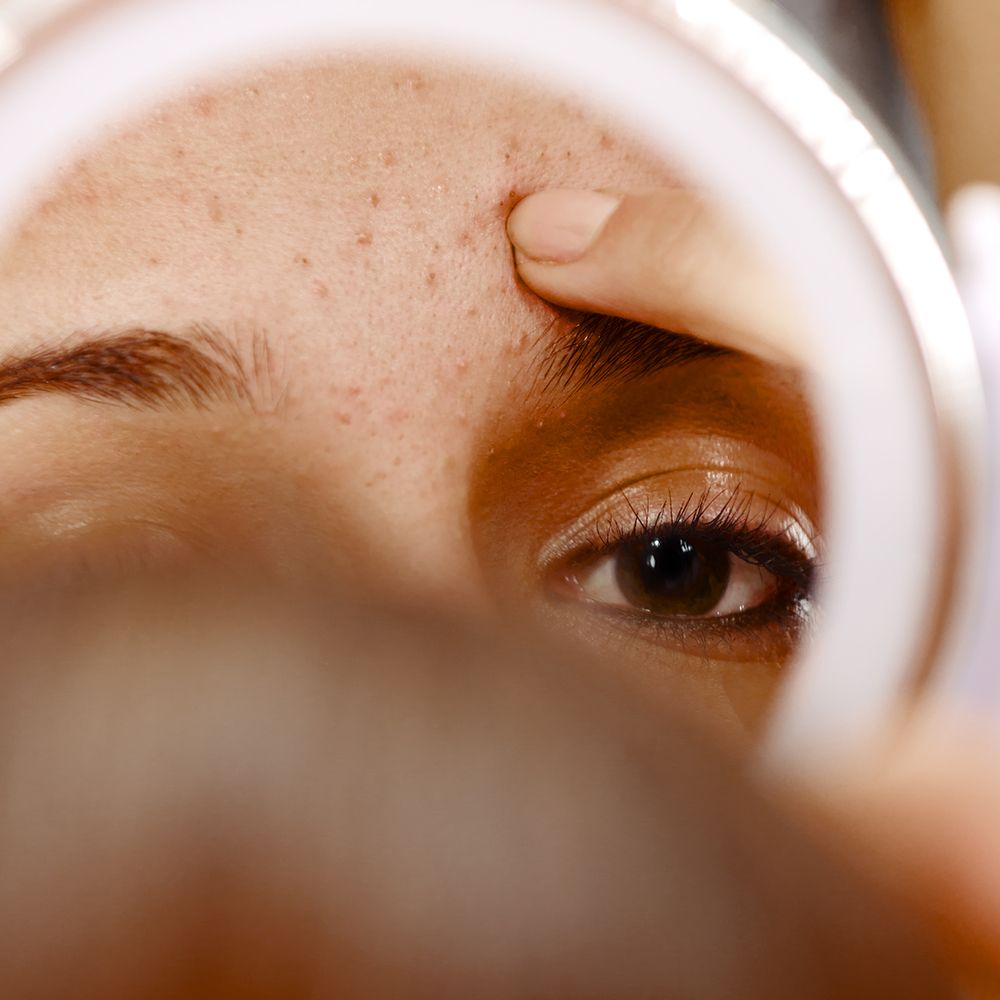 It prevents breakouts