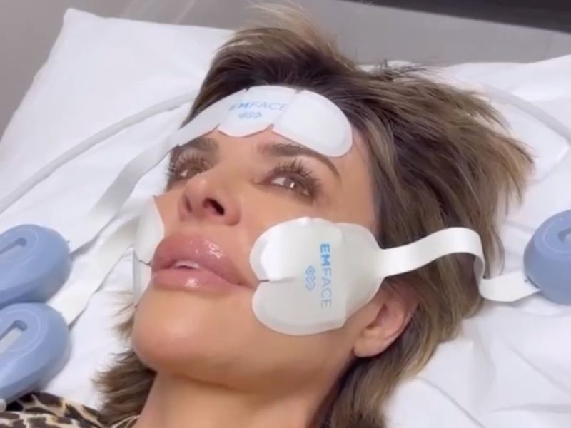 Lisa Rinna Says Her Face Is “Fresh as a Daisy” After This In-Office Treatment