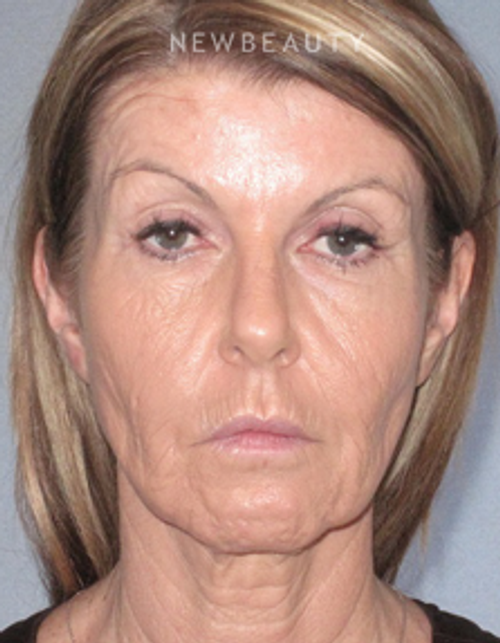 Dr. German Newall - Refreshed Look - Before