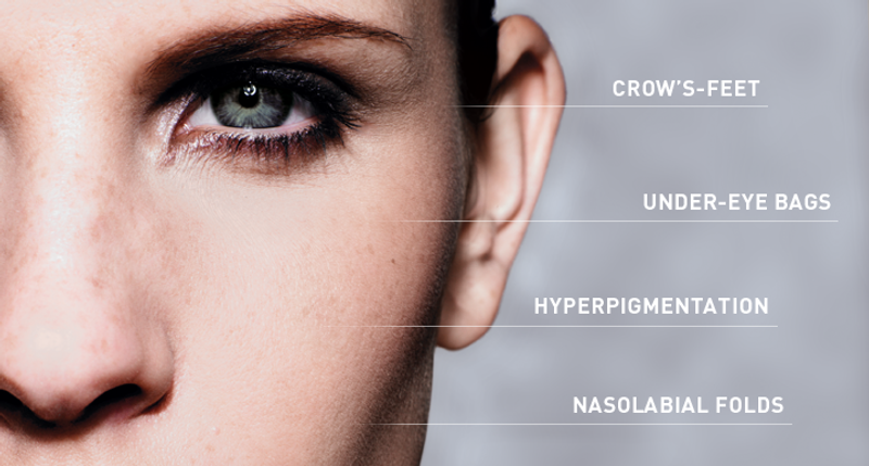 First Signs Of Aging B