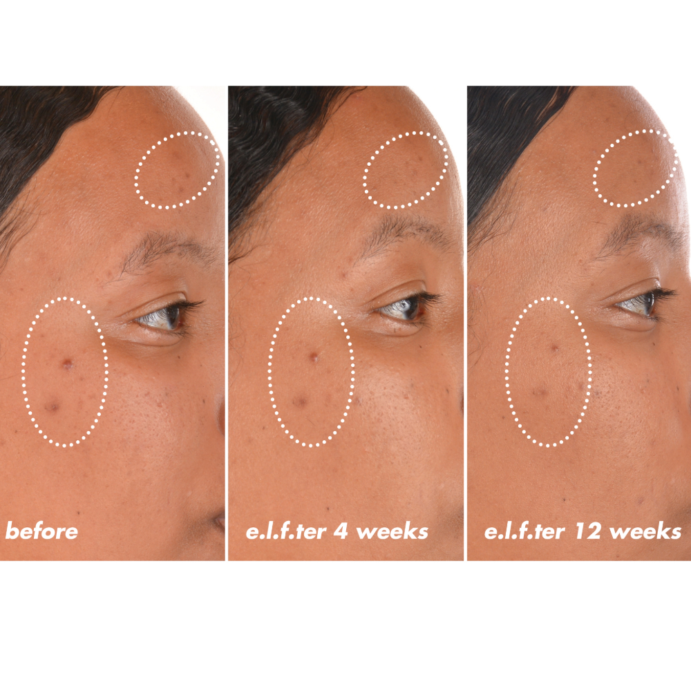 e.l.f. skin's Vitamin C + E + Ferulic Serum before and after