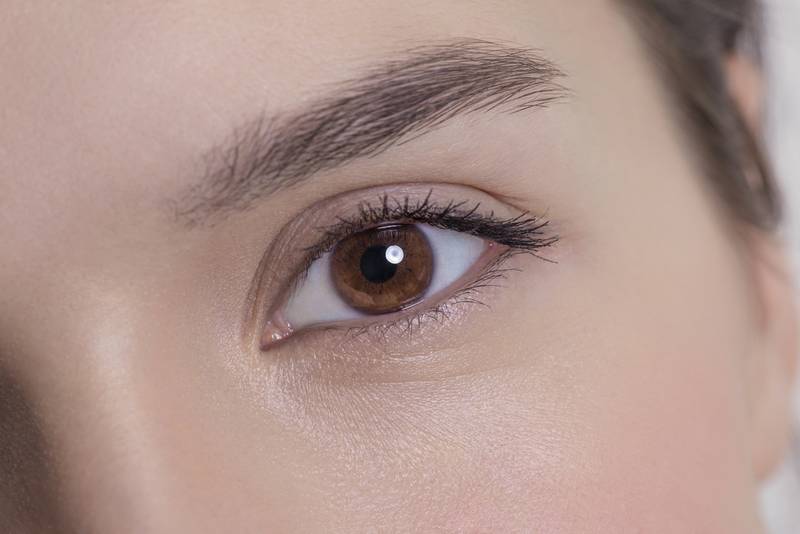 CrowsFeet
