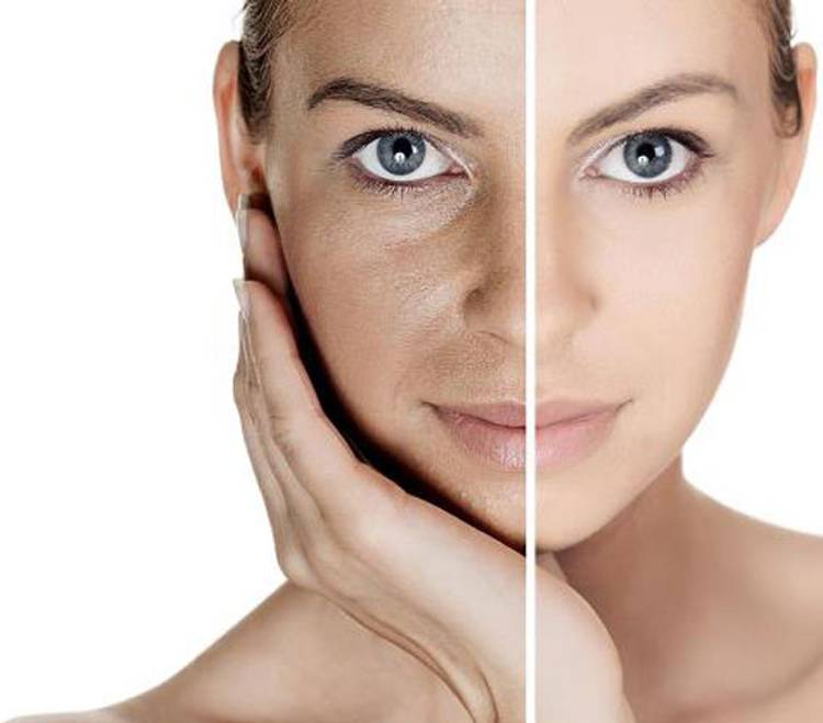 A Dull Complexion