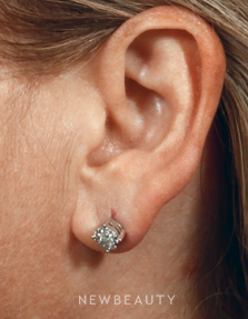 Dr. Kenneth Beer - Ear Repair - Before