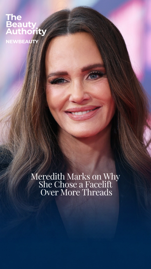 Meredith Marks Has No Regrets About Her Facelift