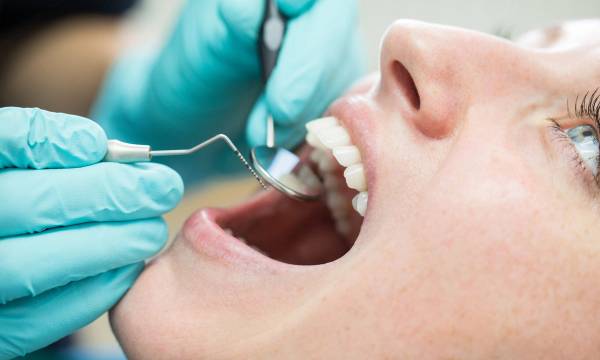 Crowns 101: Everything to Know for a Healthy, Beautiful Smile