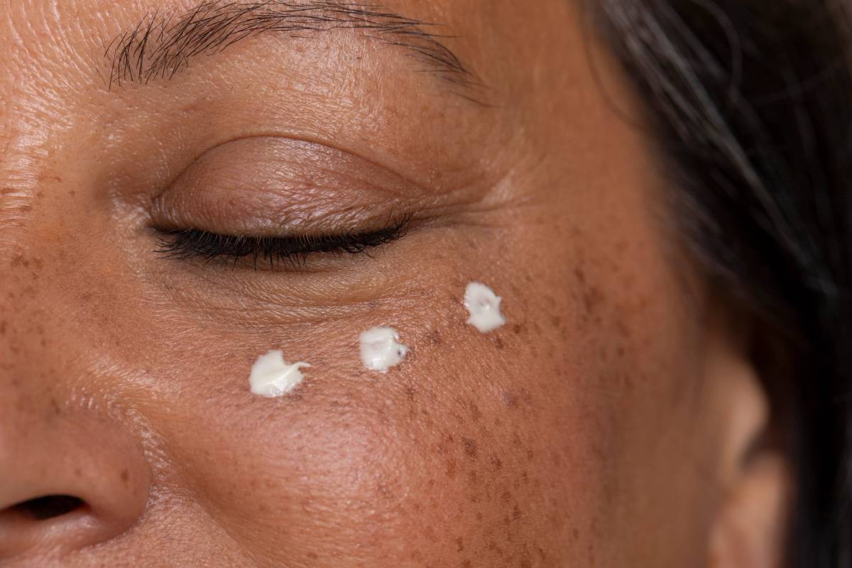 Three dabs of white eye cream on a woman’s freckled cheek beneath her closed eye.