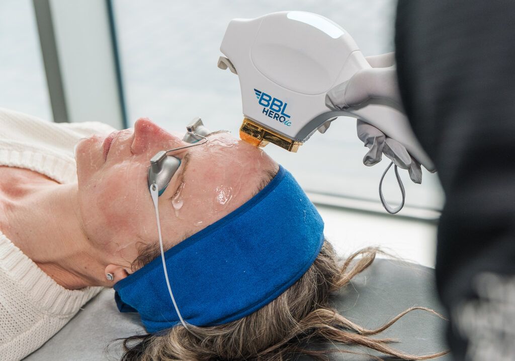 a woman lying on a table with goggles covering her eyes receiving pulsed light therapy