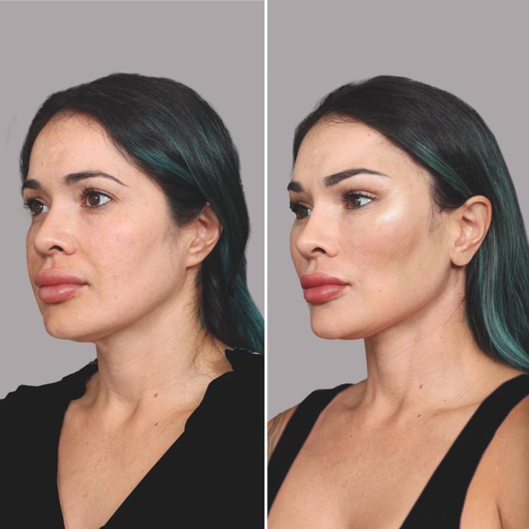 El Paso, TX plastic surgeon Ozan Sozer, MD