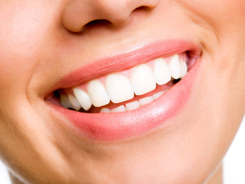 woman smiling with perfect teeth