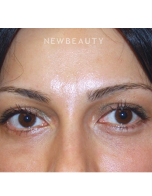 Dr. Roman Rayham - Beautiful Results - After