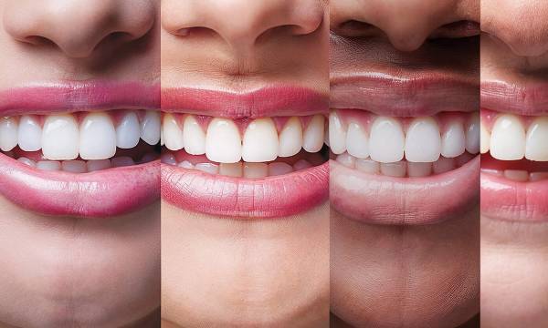 various zoomed in smiles