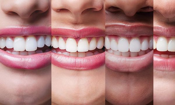 various zoomed in smiles