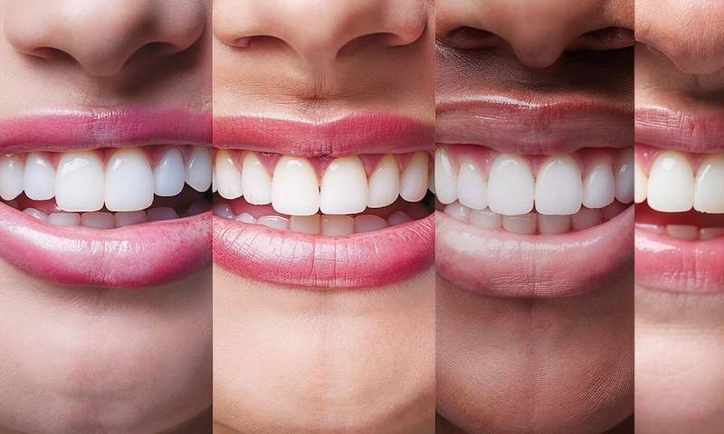 various zoomed in smiles