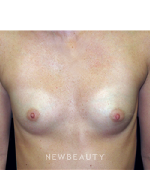 Dr. B. Aviva Preminger - Shapely Symmetry - Before