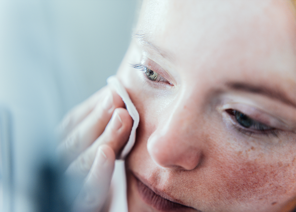 Avoid products that could further irritate your skin