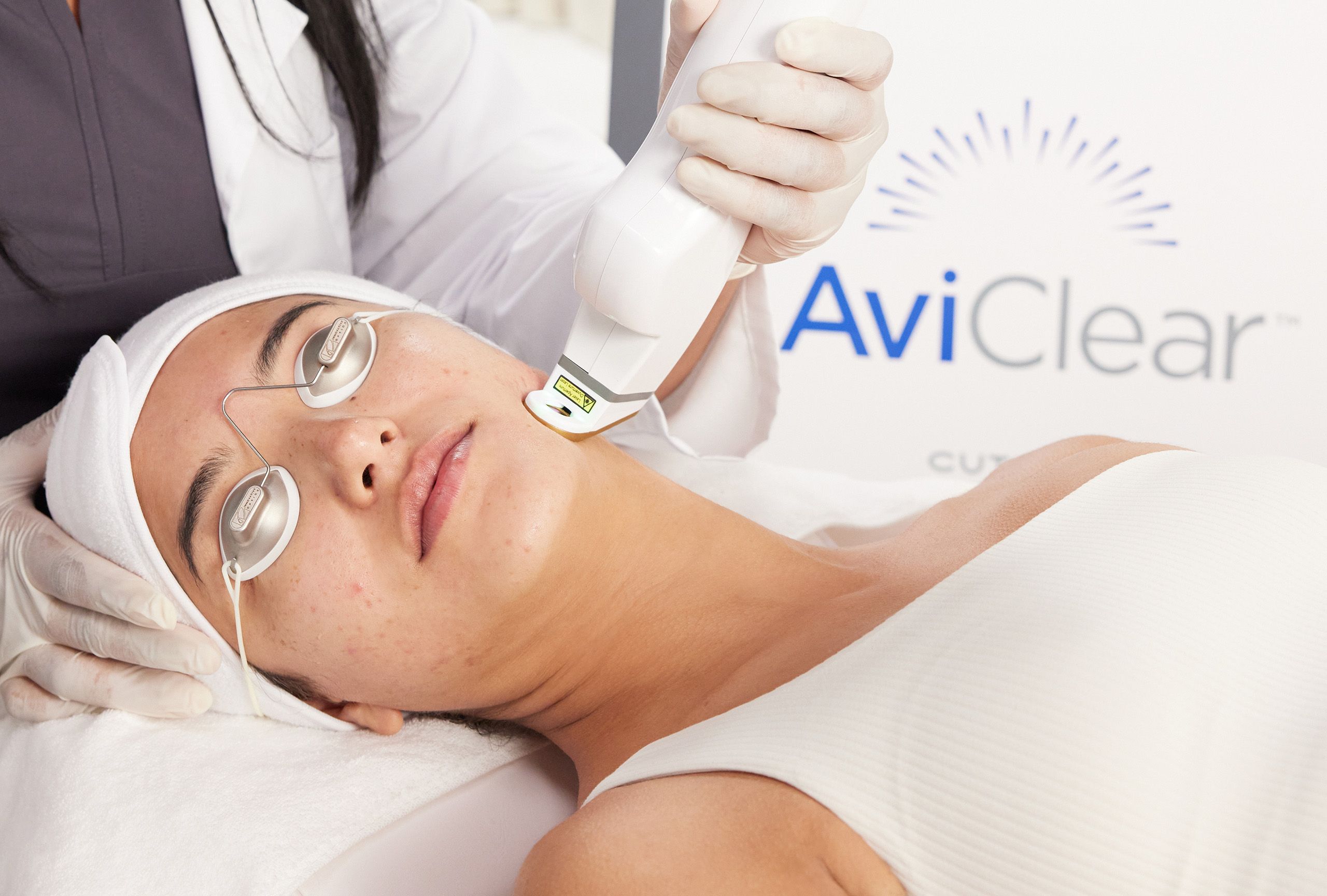 Why Dermatologists Are Turning to Lasers for Acne