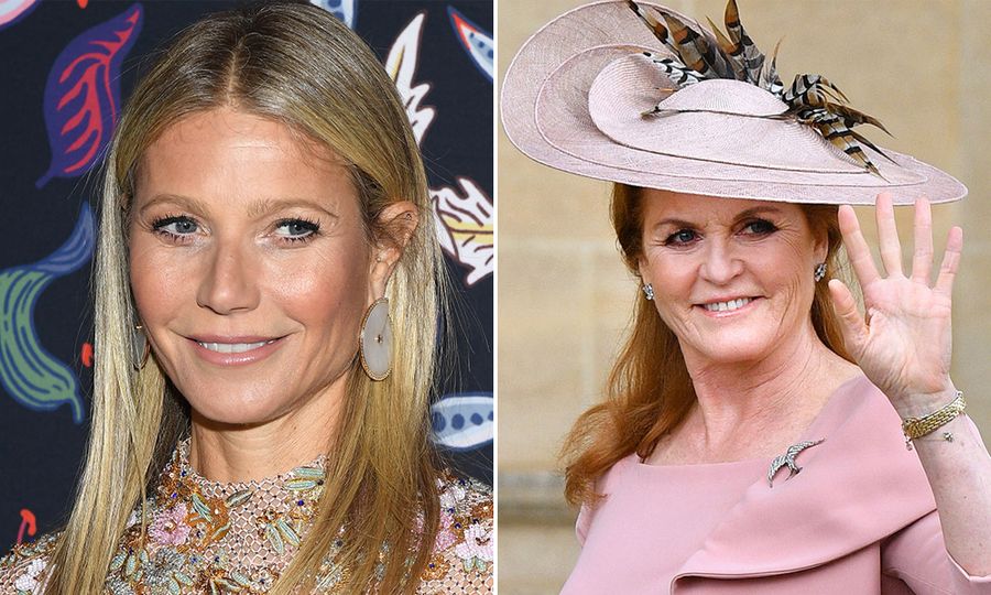 Celebrities Who Have Gotten a Thread Lift