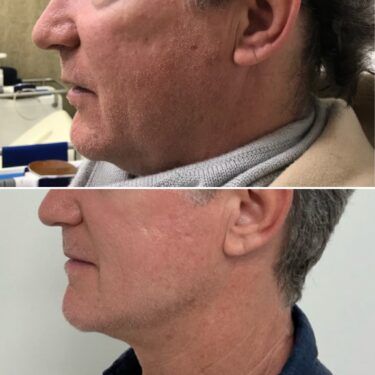 Male Injectables Dr. Russak