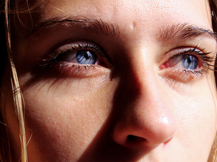 The Dry-Eye Soother