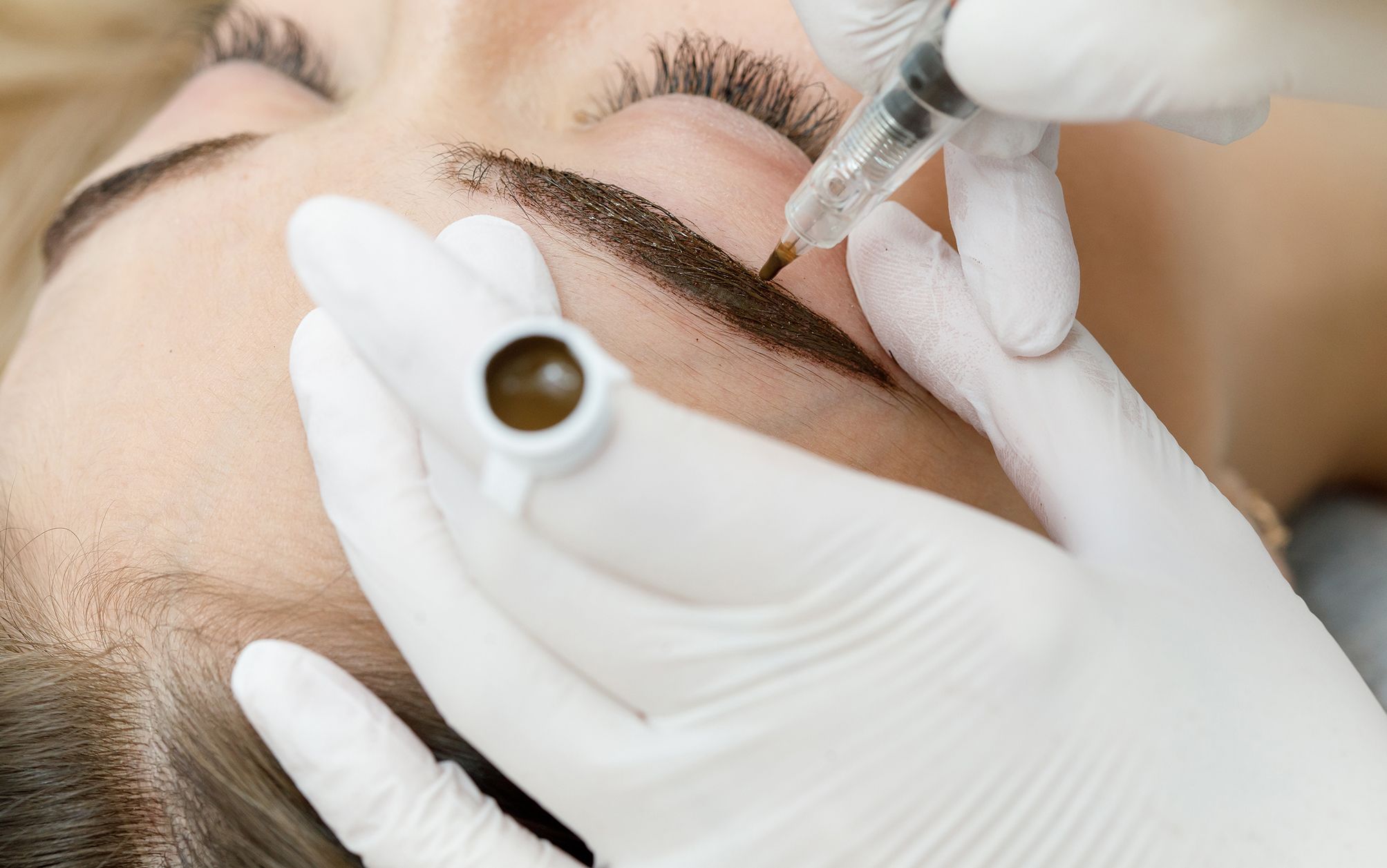 permanent makeup removal