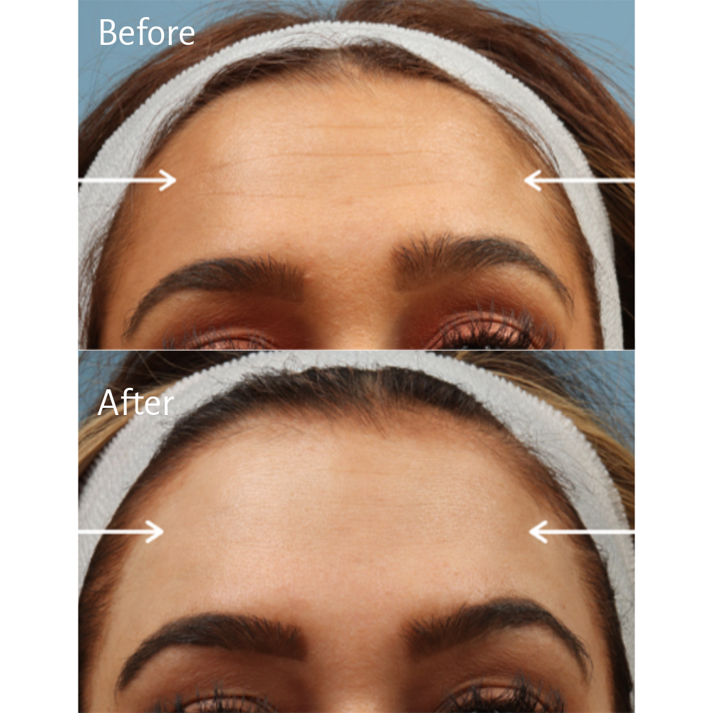 Smoothed and Refreshed