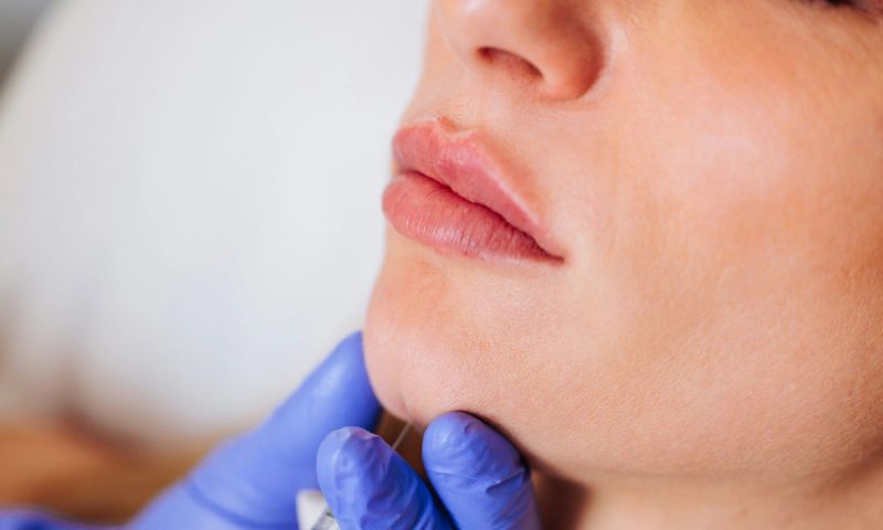 lip filler