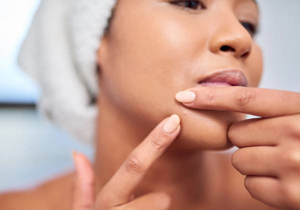 Close-up of a woman with a towel wrapped around her hair examining a chin breakout with her fingers