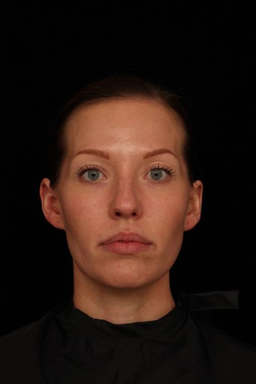 Dr. Jennifer M. Segal - Brighter Appearance - Before